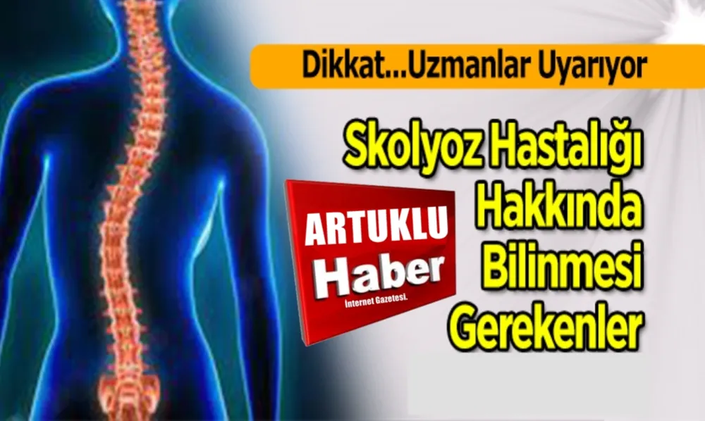 SKOLYOZ HAKKINDA  BİLİNMESİ GEREKENLER!