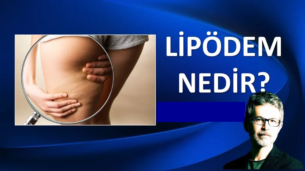 KİLO VEREMİYORSANIZ SUÇLU İRADENİZ DEĞİL, LİPÖDEM OLABİLİR