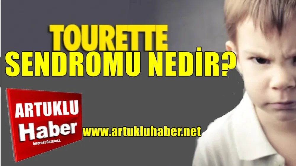 TOURETTE SENDROMU NEDİR?